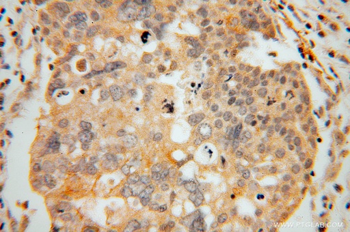 [15717-1-AP-20UL] GLYATL1 Polyclonal antibody