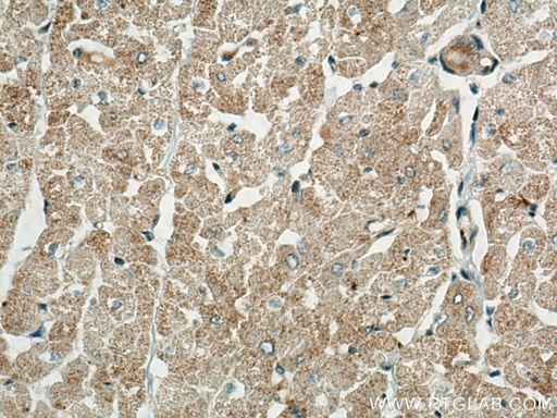 [15718-1-AP-150UL] BCKDK Polyclonal antibody