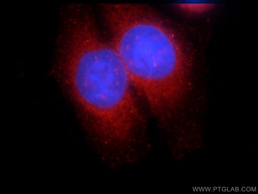 [15721-1-AP-20UL] SNX9 Polyclonal antibody