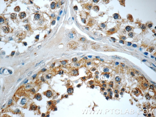 [15722-1-AP-20UL] AP2A2 Polyclonal antibody