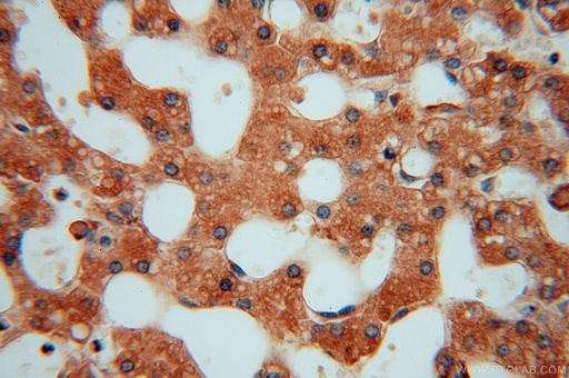 [15723-1-AP-150UL] P3H2 Polyclonal antibody