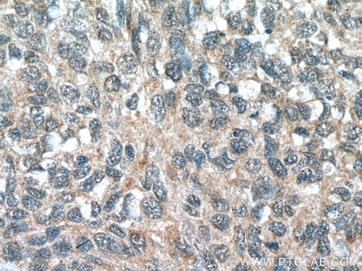 [15725-1-AP-20UL] FMO2 Polyclonal antibody
