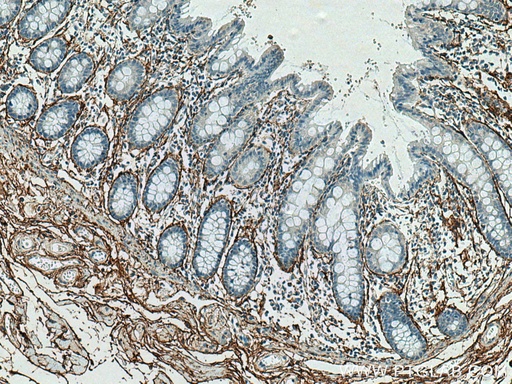 [15727-1-AP-150UL] MFAP5 Polyclonal antibody