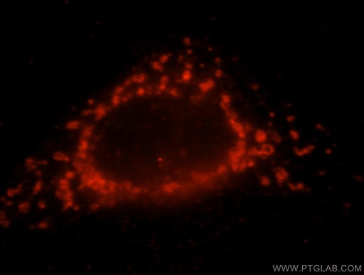 [15728-1-AP-150UL] NDUFS7 Polyclonal antibody