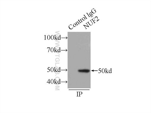 [15731-1-AP-150UL] NUF2 Polyclonal antibody