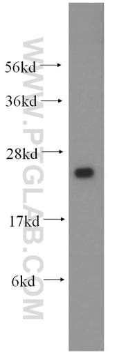 [15732-1-AP-150UL] IFT25 Polyclonal antibody