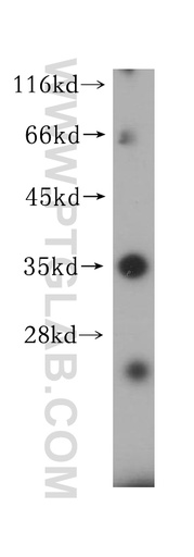 [15733-1-AP-20UL] HLA-DRB4 Polyclonal antibody