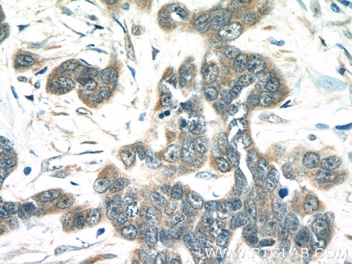 [15734-1-AP-150UL] MIA Polyclonal antibody