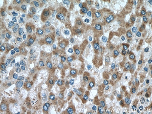 [15735-1-AP-20UL] DHRS2 Polyclonal antibody