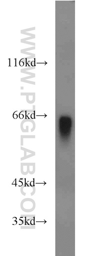 [15736-1-AP-150UL] Hemopexin Polyclonal antibody