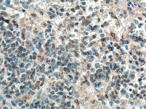 [15739-1-AP-150UL] MASTL Polyclonal antibody