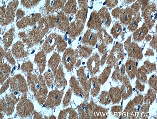 [15743-1-AP-20UL] CLPB Polyclonal antibody