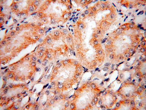 [15744-1-AP-20UL] PEX11G Polyclonal antibody