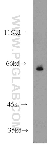[15745-1-AP-150UL] TAF6L Polyclonal antibody