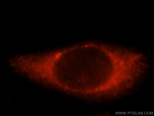 [15746-1-AP-20UL] ALDH3B2 Polyclonal antibody