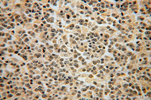 [15749-1-AP-150UL] DOK3 Polyclonal antibody