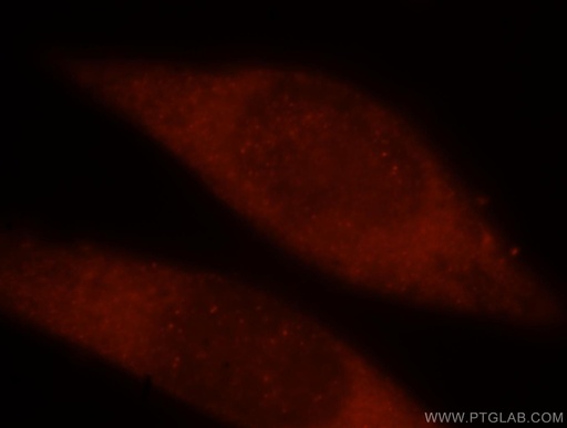 [15753-1-AP-20UL] TRBP Polyclonal antibody