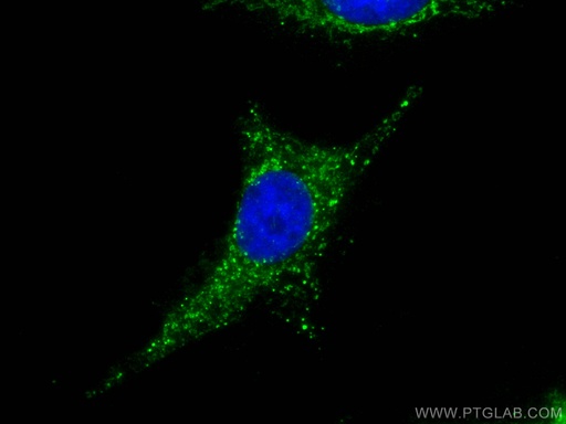 [15758-1-AP-150UL] MEK5 Polyclonal antibody