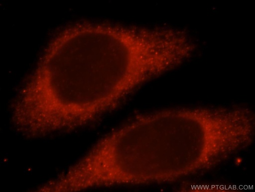 [15759-1-AP-150UL] LHPP Polyclonal antibody
