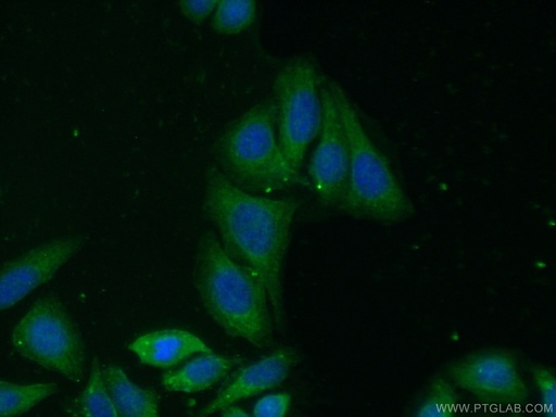 [15761-1-AP-150UL] CHMP1A Polyclonal antibody