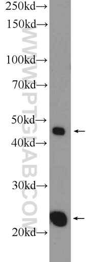 [15764-1-AP-150UL] MID1IP1 Polyclonal antibody