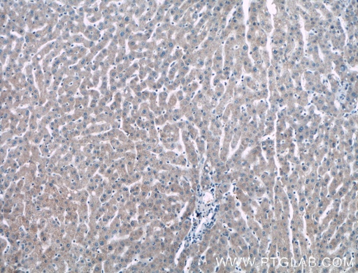 [15765-1-AP-20UL] NMRAL1 Polyclonal antibody