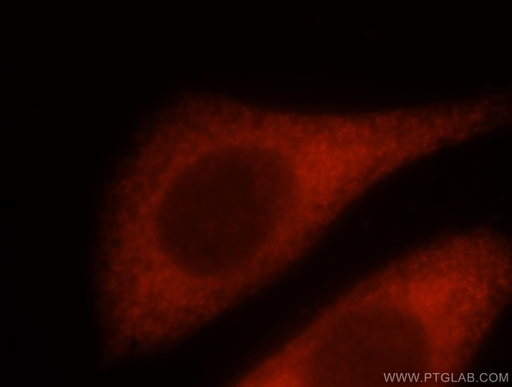 [15767-1-AP-20UL] NQO2 Polyclonal antibody