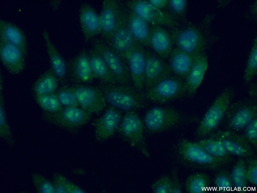 [15769-1-AP-20UL] DDX24 Polyclonal antibody