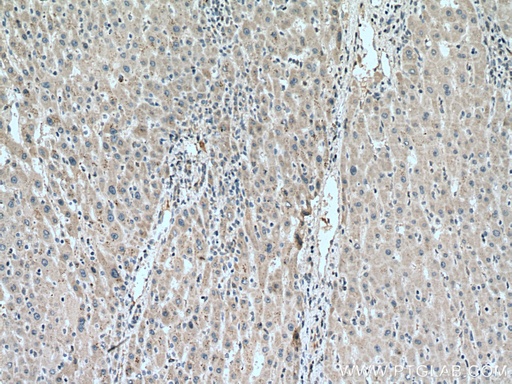 [15770-1-AP-20UL] ACAD9 Polyclonal antibody