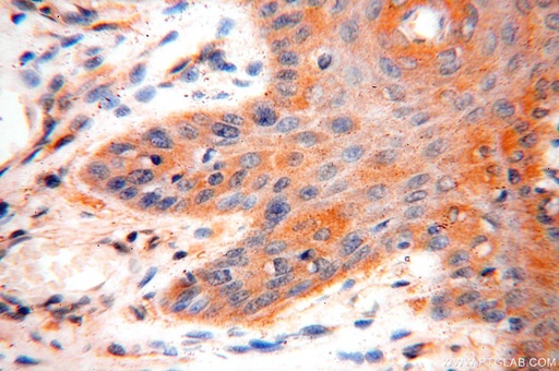 [15771-1-AP-150UL] VAC14 Polyclonal antibody