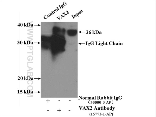 [15773-1-AP-150UL] VAX2 Polyclonal antibody