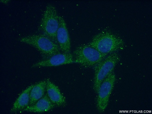 [15776-1-AP-20UL] VARS2 Polyclonal antibody