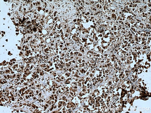 [15778-1-AP-20UL] ENY2 Polyclonal antibody
