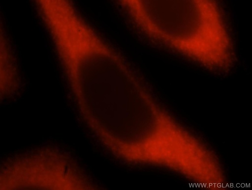 [15782-1-AP-20UL] TBCB Polyclonal antibody