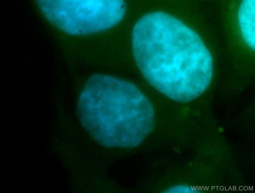[15784-1-AP-20UL] RBM41 Polyclonal antibody