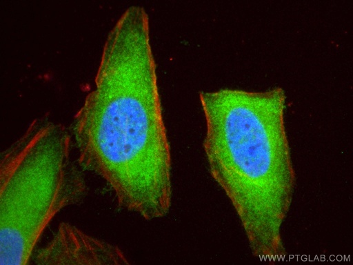 [15786-1-AP-20UL] VTA1 Polyclonal antibody