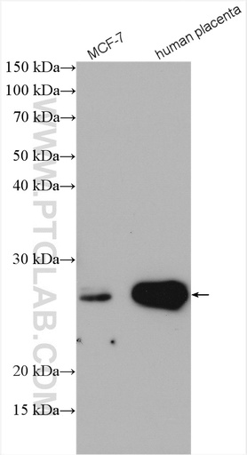 [15787-1-AP-150UL] Grancalcin Polyclonal antibody