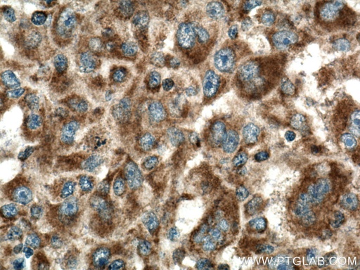 [15789-1-AP-150UL] PIN4 Polyclonal antibody