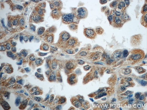 [15790-1-AP-150UL] TNFAIP8 Polyclonal antibody