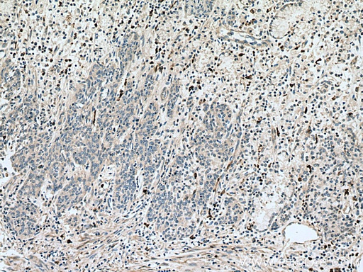 [15792-1-AP-20UL] S100A8 Polyclonal antibody