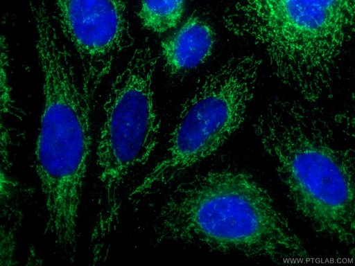 [15793-1-AP-20UL] DAP13 Polyclonal antibody