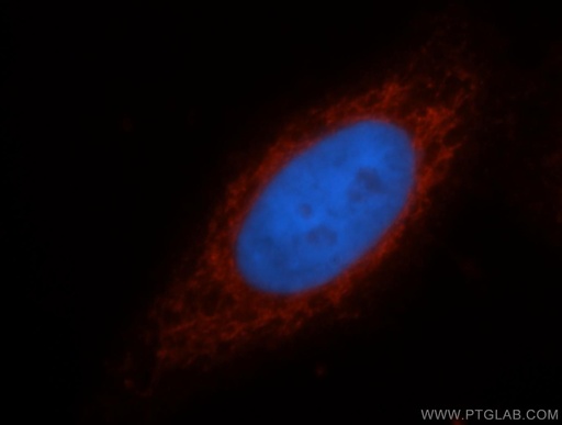 [15794-1-AP-20UL] ATF6B Polyclonal antibody