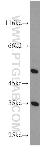 [15797-1-AP-150UL] ATPAF1 Polyclonal antibody