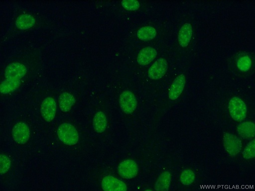 [15798-1-AP-150UL] CIP29 Polyclonal antibody