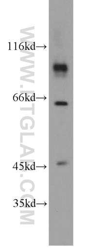 [15801-1-AP-20UL] CHPF-N terminal Polyclonal antibody