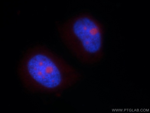 [15802-1-AP-20UL] NHP2L1 Polyclonal antibody