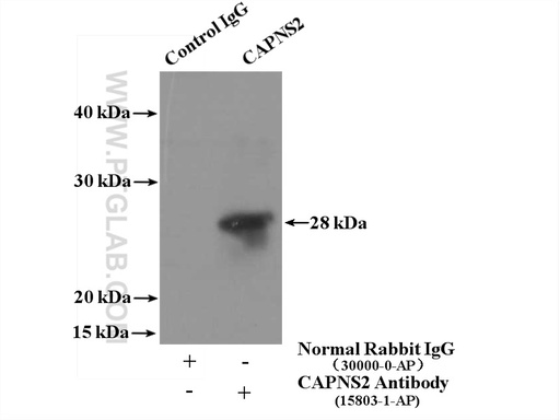[15803-1-AP-20UL] Calpain S2 Polyclonal antibody