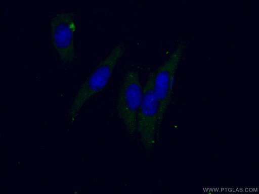 [15804-1-AP-20UL] GLRX Polyclonal antibody