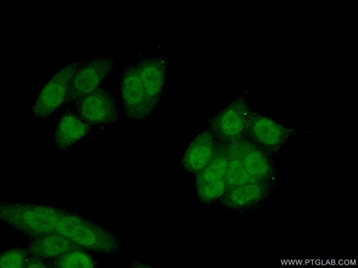 [15807-1-AP-20UL] NAT5 Polyclonal antibody