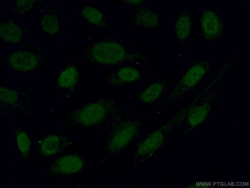 [15808-1-AP-20UL] Alpha B Crystallin Polyclonal antibody